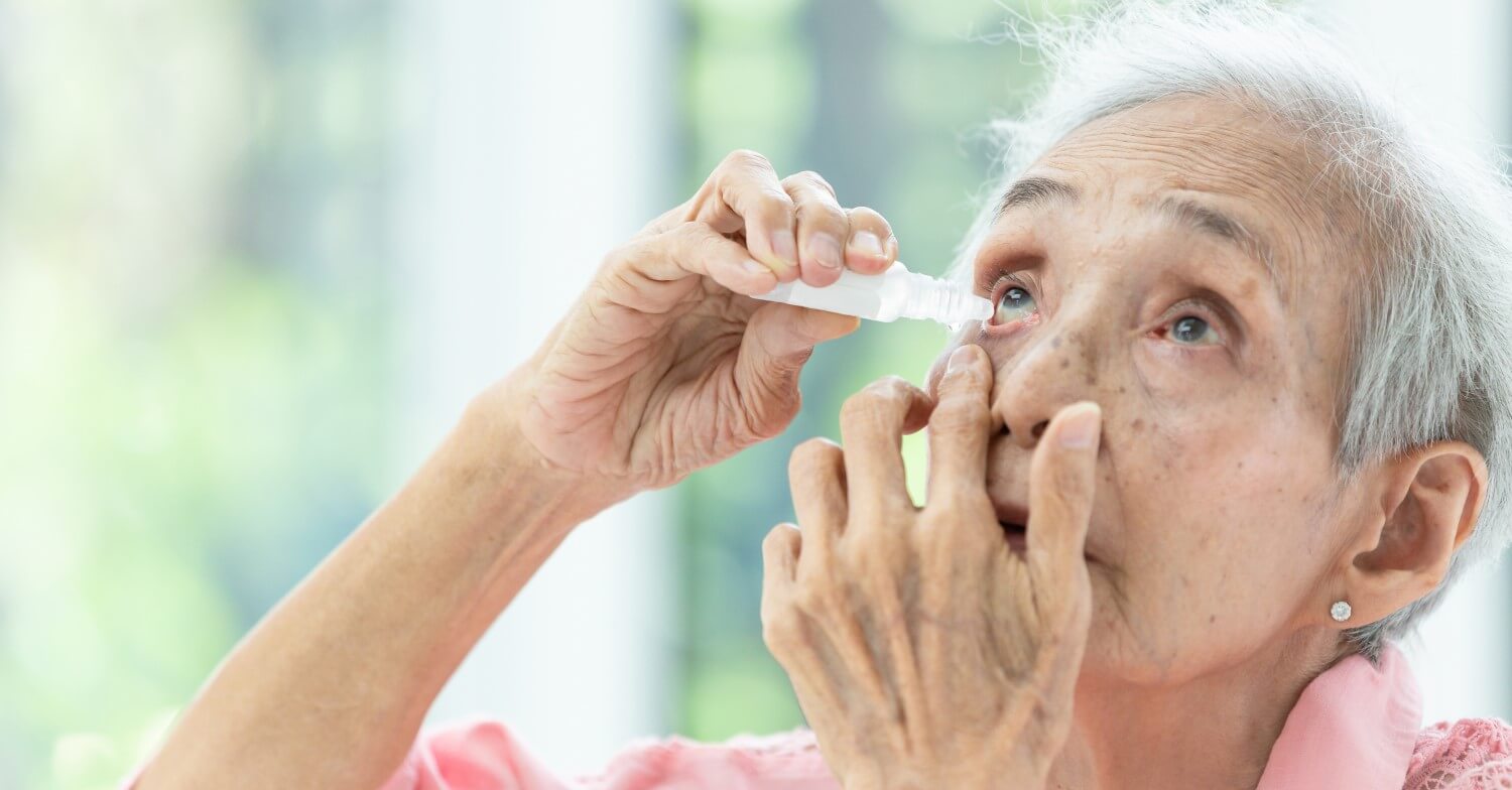 Eine ältere, grauhaarige Frau träufelt sich Augentropfen ins Auge, sie hat den Kopf dazu leicht nach hinten geneigt